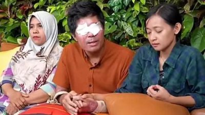 Agus Salim Korban Siram Air Keras bersama istrinya dan keluarganya