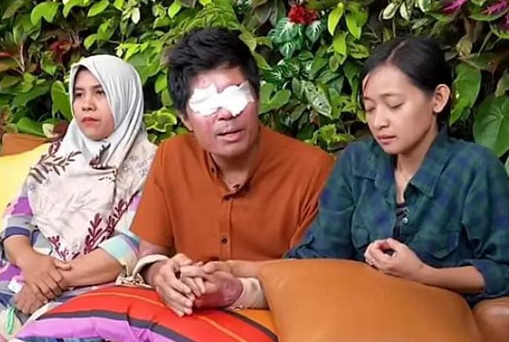 Agus Salim Korban Siram Air Keras bersama istrinya dan keluarganya