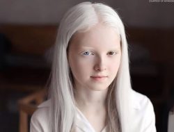 Amina Eppendieva, Gadis Albino Rusia dengan Pesona Unik: Rambut Putih, Mata Coklat dan Biru