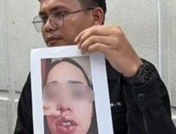 Mantan Finalis Ajang Kecantikan Ditangkap: Diduga Buka Praktik Dokter Gadungan, Akibatkan Korban Cacat Permanen