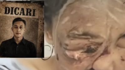 BURON! Polisi Buru Pelaku Penganiayaan Sadis Wanita di Bandung hingga Cacat Permanen